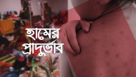 হামের উপসর্গে আরও ৭ জনের মৃত্যু, নতুন আক্রান্ত ১,২৮৭