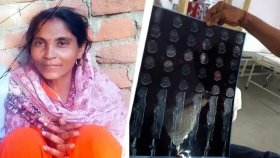 ভাঙা হাড়ের চিকিৎসায় হাসপাতালে ভর্তি, হৃদযন্ত্রের অস্ত্রোপচারে নারীর মৃত্যু
