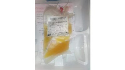 প্লাটিলেটের ছবি সংগৃহীত