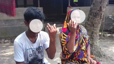 অ্যানথ্রাক্স আক্রান্ত রোগী (ফাইল ছবি)
