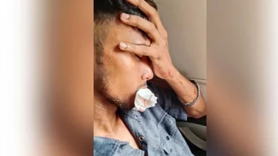 আহত যাত্রী মোহাম্মদ হিমেল আহমেদের চারটি দাঁত ভেঙে গেছে