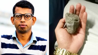 পাথরটি শ্যামল চন্দ্র দাসের ডান চোখে আঘাত হানে