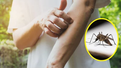কারও শরীর মশার কাছে তুলনামূলক বেশি আকর্ষণীয় হয়ে উঠতে পারে। ছবি: বাংলা ট্রিবিউন কোলাজ