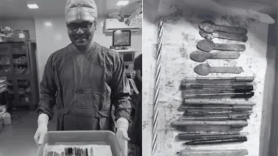 ভারতের অন্ধ্রপ্রদেশের পালনাদু জেলায় নারীর পেট থেকে উদ্ধার করা বস্তুগুলো দেখাচ্ছেন চিকিৎসক। ছবি: জিও নিউজ