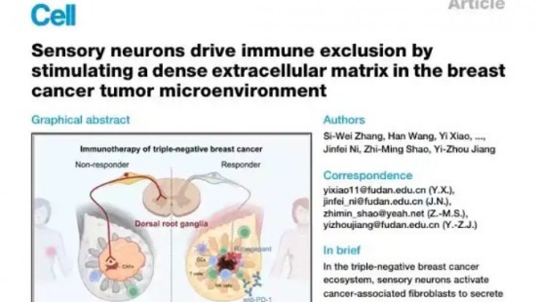 স্তন ক্যান্সারের একটি ভয়ানক ধরন হলো ট্রিপল-নেগেটিভ ব্রেস্ট ক্যানসার বা টিএনবিসি। ছবি: চায়না ডেইলি