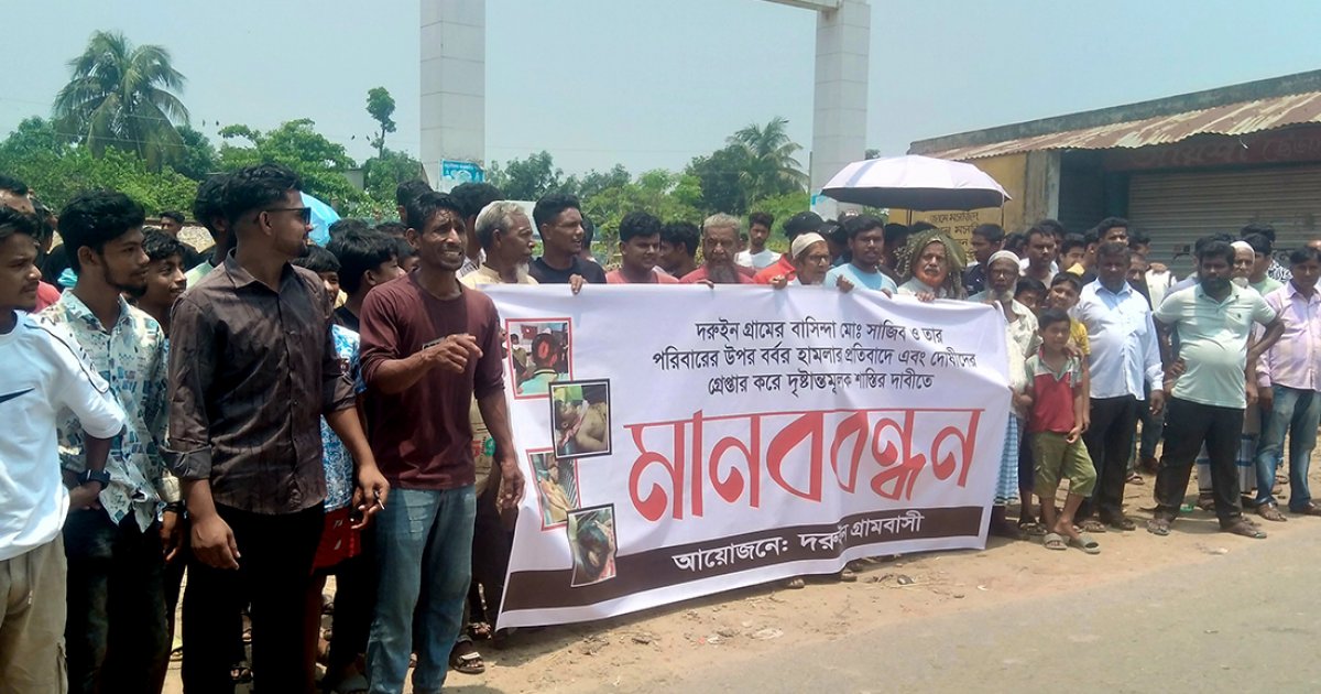 কোপানোর মামলায় জামিন না পেয়ে এবার ভাঙা হলো বাদীর হাত-পা