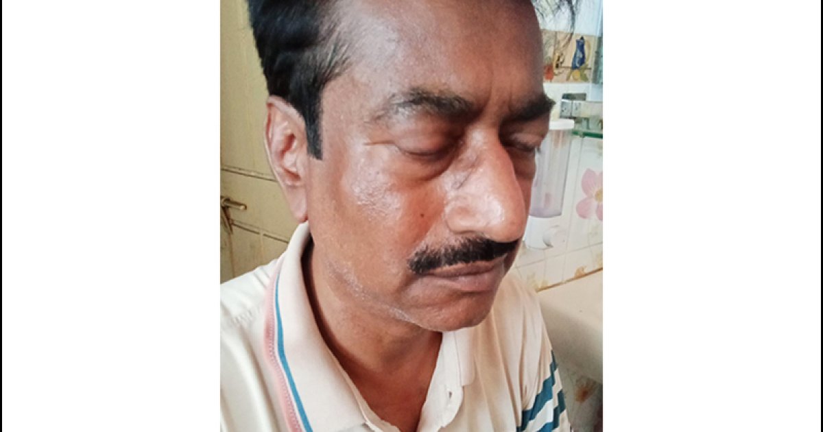 বিএনপির নেতার মারধরে যুবদল নেতা আহত