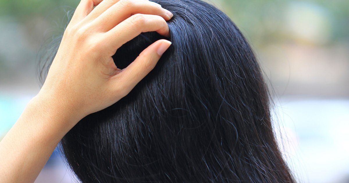 ঘামে ভিজে চুলকাচ্ছে মাথার ত্বক?