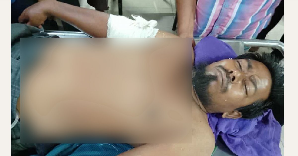 গোপালগঞ্জে রিকশাচালক গুলিবিদ্ধ, ঢামেকে চিকিৎসাধীন