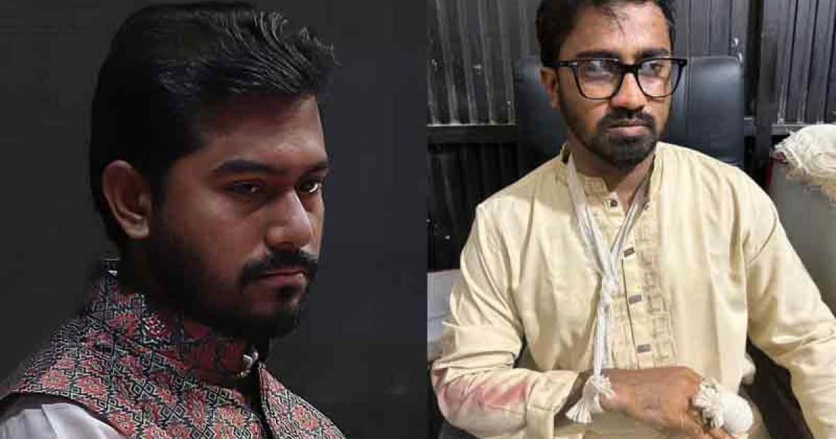 নুরের অবস্থা ‘মুমূর্ষু’, চিকিৎসকদের অবজারভেশনে