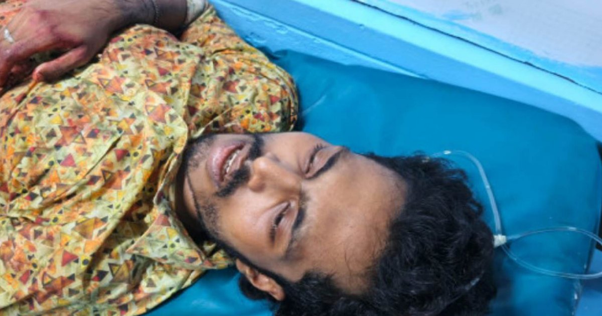 খুলনায় গুলিতে যুবক আহত