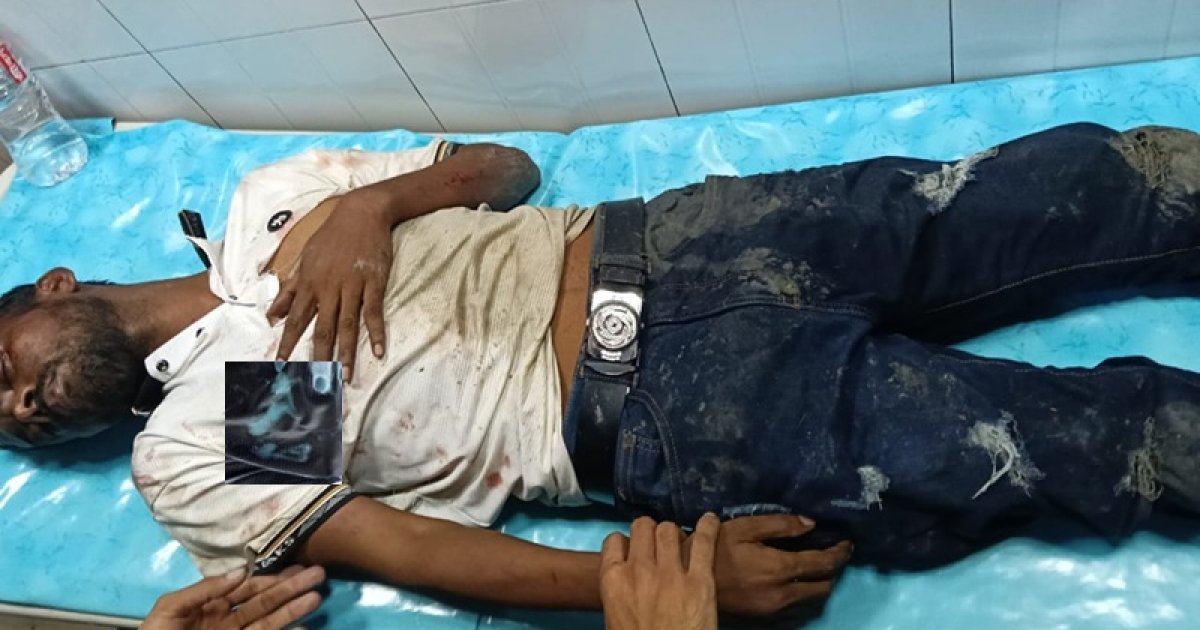 আফতাবনগরে হিরো আলমের ওপর হামলা
