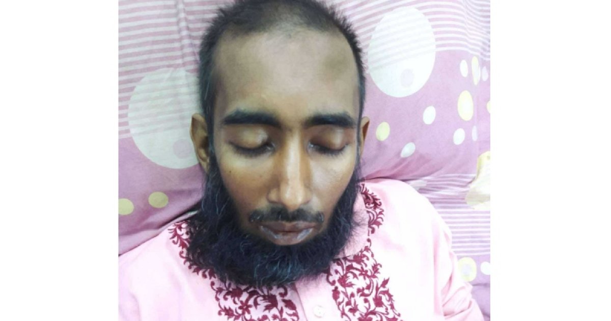 কিডনি রোগে ভুগছেন কোরআনে হাফেজ, চিকিৎসার জন্য লাগবে ১৫ লাখ
