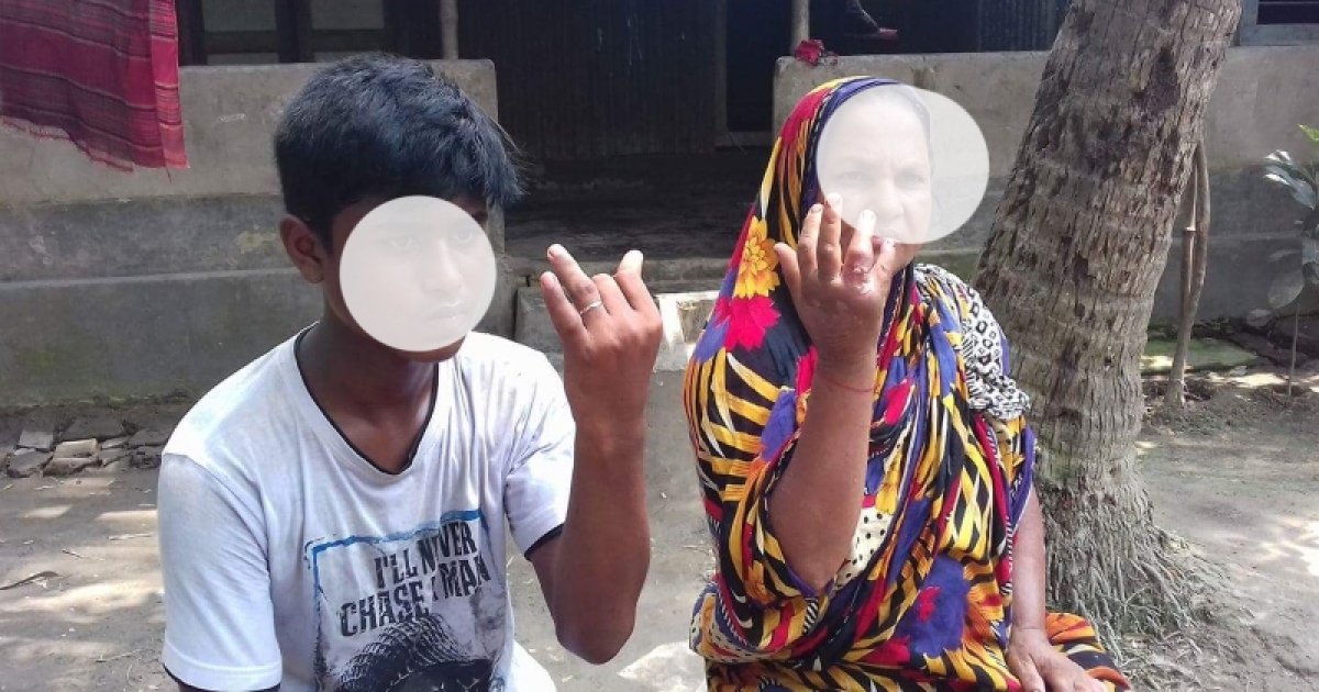 অ্যানথ্রাক্স প্রতিরোধে সরকারের সমন্বিত কার্যক্রম শুরু