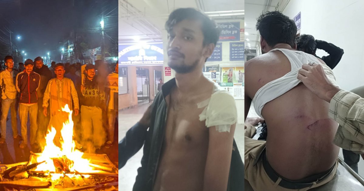 জুলাইয়ে ছাত্রলীগ থেকে পদত্যাগ করা সেই ফারাবীসহ ৩ জনকে পিটিয়ে আহত