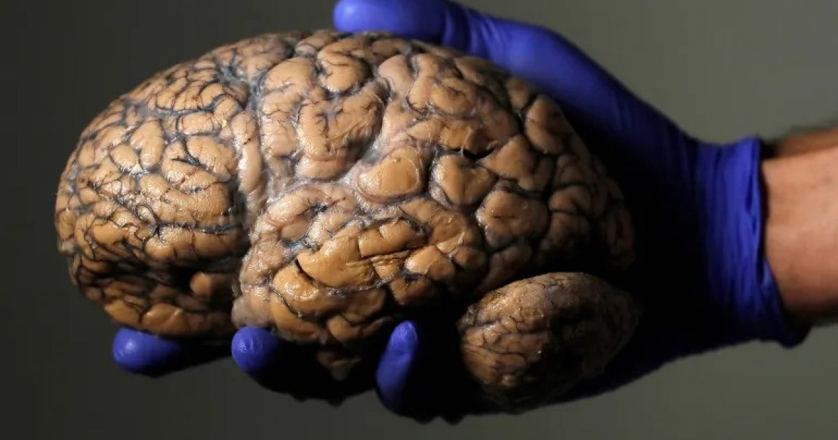 বয়ঃসন্ধিকাল ৩২ বছর পর্যন্ত? মানব মস্তিষ্কের উন্নয়ন নিয়ে নতুন অনুসন্ধান