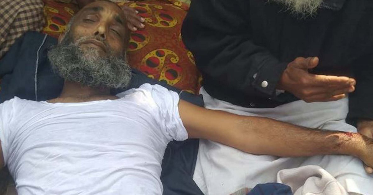পাথরঘাটায় জামায়াত নেতাকে লাঠিপেটা করে গুরুতর আহত, দুই পা ভেঙেছে