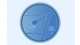 নতুন আতঙ্কের নাম ব্ল্যাক ফাঙ্গাস