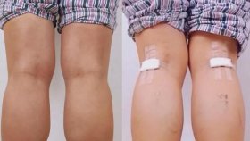 সৌন্দর্যের নামে চীনা মেয়েরা এ কী করছে!