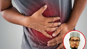 কোষ্ঠকাঠিন্যমুক্ত ঈদ কাটাতে যা করবেন