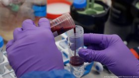 ‘যুগান্তকারী’ পরীক্ষা বদলাতে পারে ক্যানসার চিকিৎসা