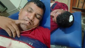 থানায় নেওয়ার পথে দুই পুলিশকে হাতুড়িপেটা করলো আসামি