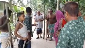 পলাশবাড়ীতে অচেনা প্রাণীর আক্রমণে নারী-শিশুসহ ১৫ জন আহত