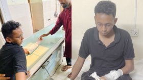 স্থানীয়দের হামলায় চট্টগ্রাম বিশ্ববিদ্যালয়ের ৩ শিক্ষার্থী আহত