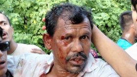 সেন্টমার্টিনে সালিশ বৈঠকে ইউপি সদস্যের ওপর হামলা