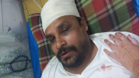 লালন আখড়ায় হামলা চালিয়ে সাংবাদিককে কুপিয়ে জখম, বিএনপি নেতা আটক