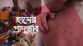হামের উপসর্গে ফের প্রাণহানি, মোট মৃত্যু ৬৩১