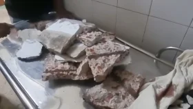 সরকারি হাসপাতালে সার্জারি ওয়ার্ডে পলেস্তারা পড়ে ৩ রোগী আহত