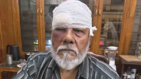 রাস্তায় হামলার শিকার সাবেক সচিব, মার খেয়ে করলেন মামলা