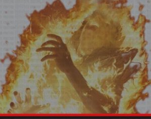 পল্টনে সেলুনের এসি বিস্ফোরণে দগ্ধ তিন