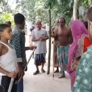 পলাশবাড়ীতে অচেনা প্রাণীর আক্রমণে নারী-শিশুসহ ১৫ জন আহত