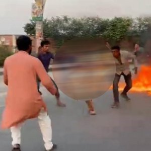 সড়কে দেওয়া আগুন শরীরে ধরে গেলো ছাত্রদল নেতার, হাসপাতালে ভর্তি