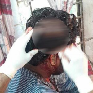 শিক্ষার্থীদের পরীক্ষা না নেওয়ায় শিক্ষকের মাথা ফাটালেন যুবদল নেতা