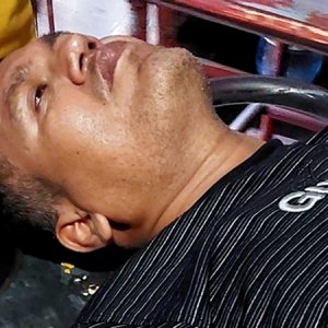 আসামি ধরার সময় পুলিশ কর্মকর্তাকে ছুরিকাঘাত আসামি ধরার সময় পুলিশ কর্মকর্তাকে ছুরিকাঘাত