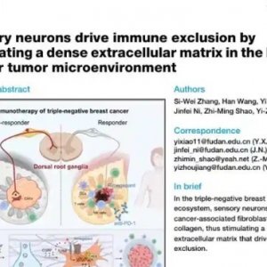 ওষুধ প্রতিরোধী স্তন ক্যান্সারের সমাধান-সূত্র পেলেন চীনা বিজ্ঞানীরা