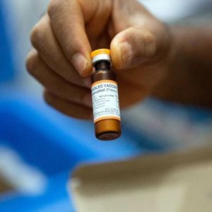 হাম থেকে শিশুকে সুরক্ষিত রাখবেন যেভাবে