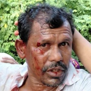সেন্টমার্টিনে সালিশ বৈঠকে ইউপি সদস্যের ওপর হামলা