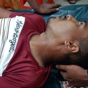 অটোরিকশায় এসে রাস্তায় দাঁড়িয়ে থাকা যুবককে কয়েকটি গুলি