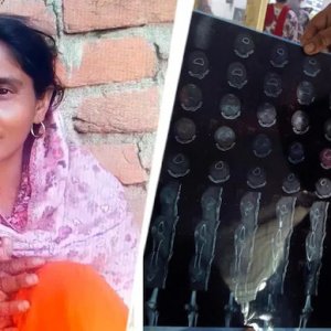 ভাঙা হাড়ের চিকিৎসায় হাসপাতালে ভর্তি, হৃদযন্ত্রের অস্ত্রোপচারে নারীর মৃত্যু