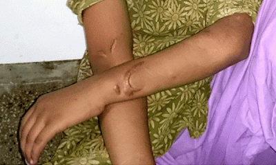 নির্যাতনের শিকার এক শিশু গৃহশ্রমিক
