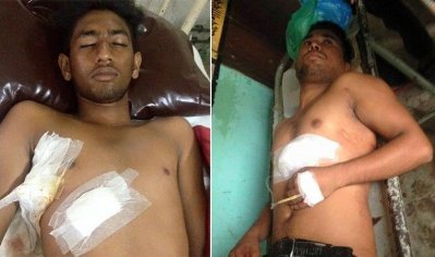 আহত দুই শিক্ষার্থী