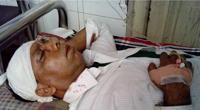 ফেনী প্রেসক্লাবে চার সাংবাদিককে কুপিয়ে জখমের প্রতিবাদে মানববন্ধন