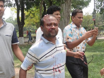 আহত কর্মকর্তা মোর্শেদ