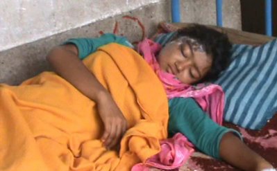 এসিডে আহত রুবাইয়া আখতার রিতু