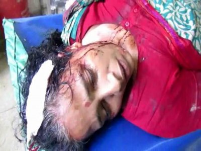সংঘর্ষে আহত কয়েকজন
