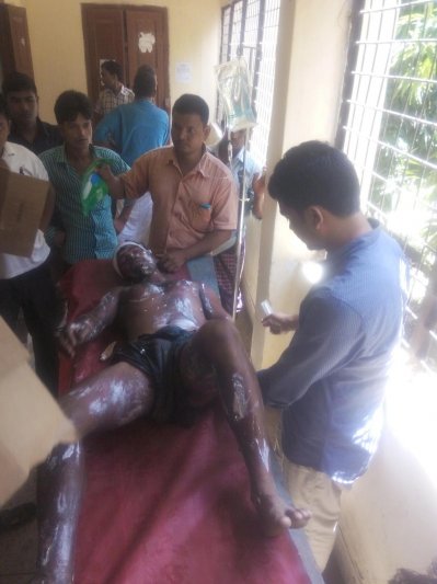 বয়লার বিস্ফোরণে আহত এক ব্যক্তির চিকিৎসা দেওয়া হচ্ছে